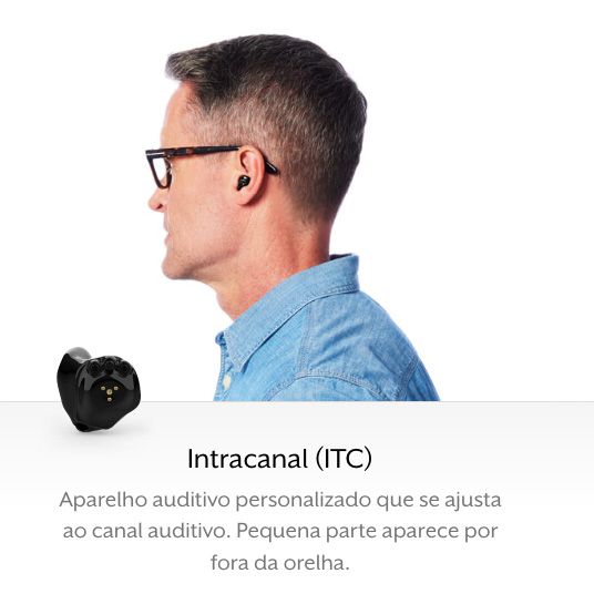 Intracanal(ITC)